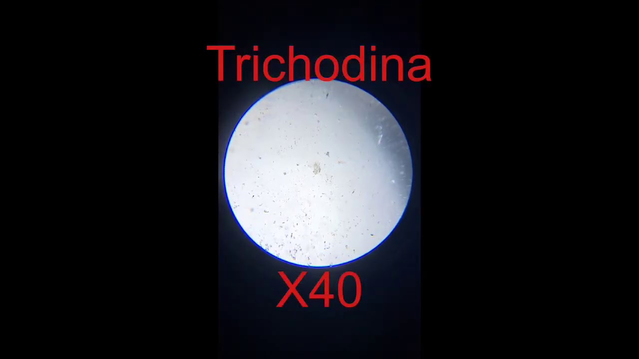 How to identify skin flukes, trichodina and costia under a microscope