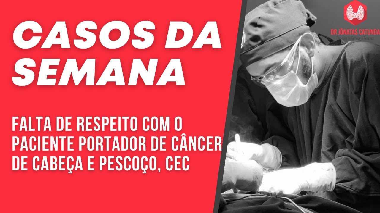 Casos da semana - falta de respeito com o paciente portador de câncer de cabeça e pescoço, CEC