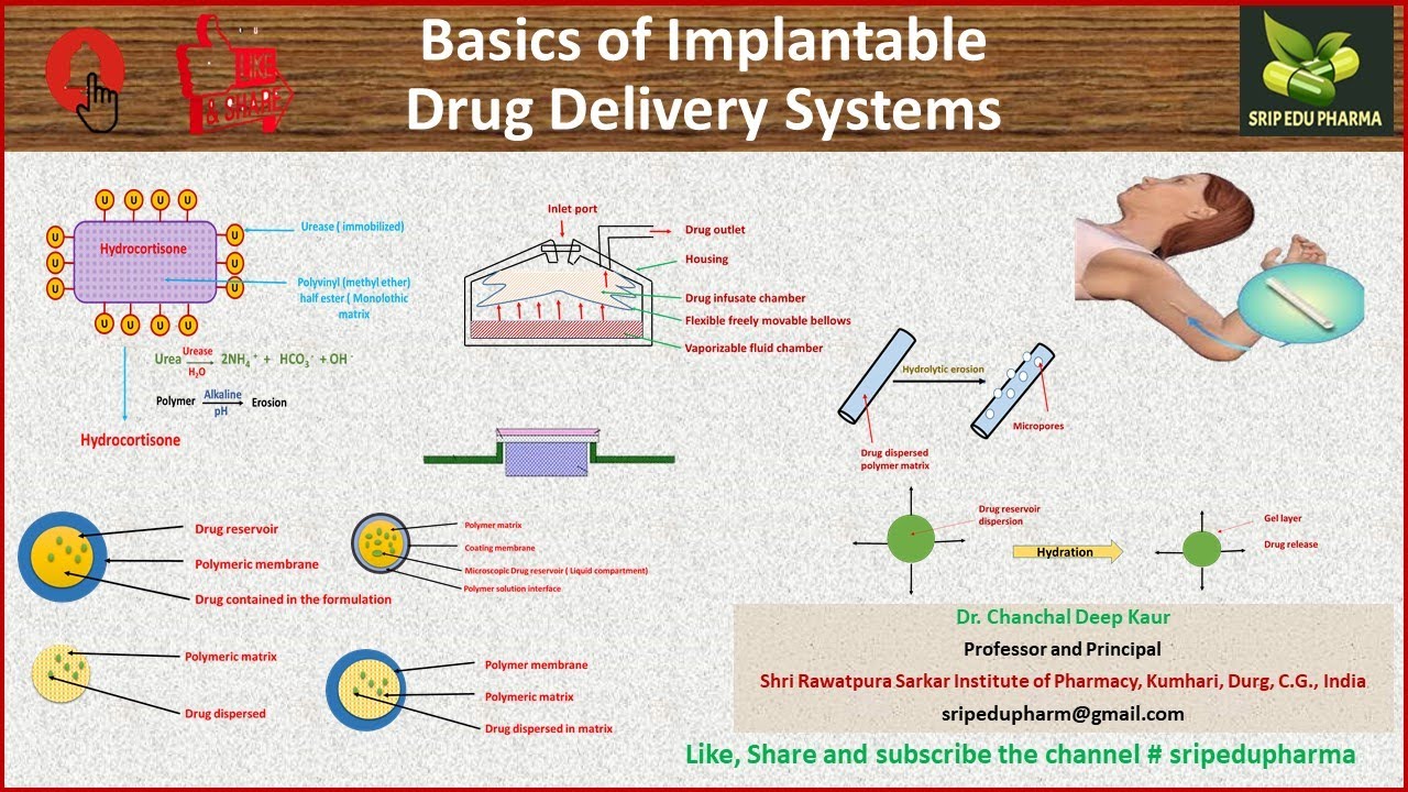 Basics of Implantable Drug Delivery Systems