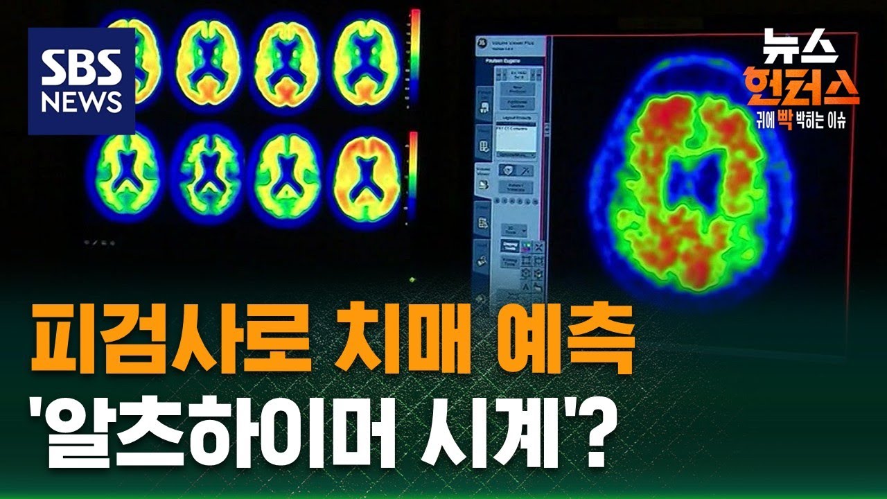 [이슈빡] 피검사로 치매 예측…'알츠하이머 시계'? / SBS / 뉴스헌터스