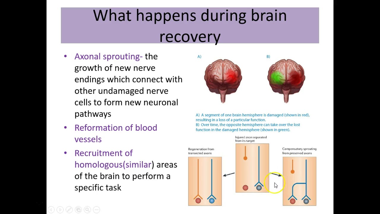plasticity and functional recovery of the brain after trauma