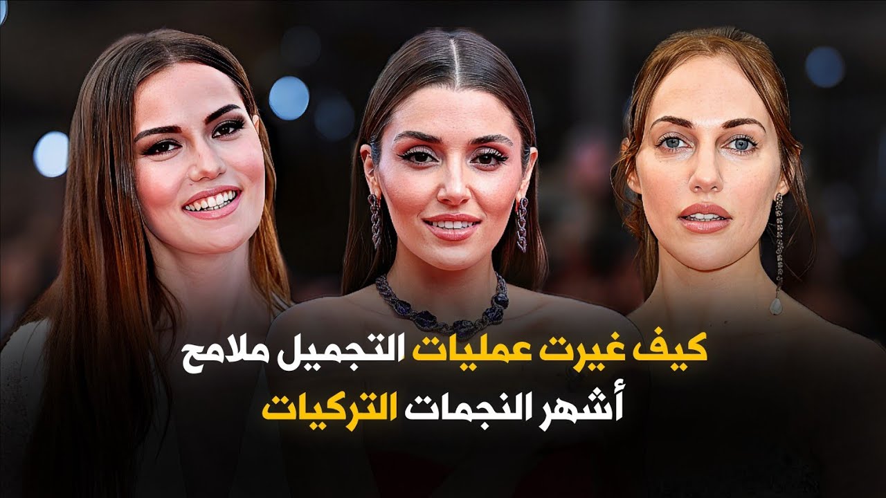 ڪيف غيرت عمليات التجميل ملآمح أشهـر النجمات الترڪيات؟