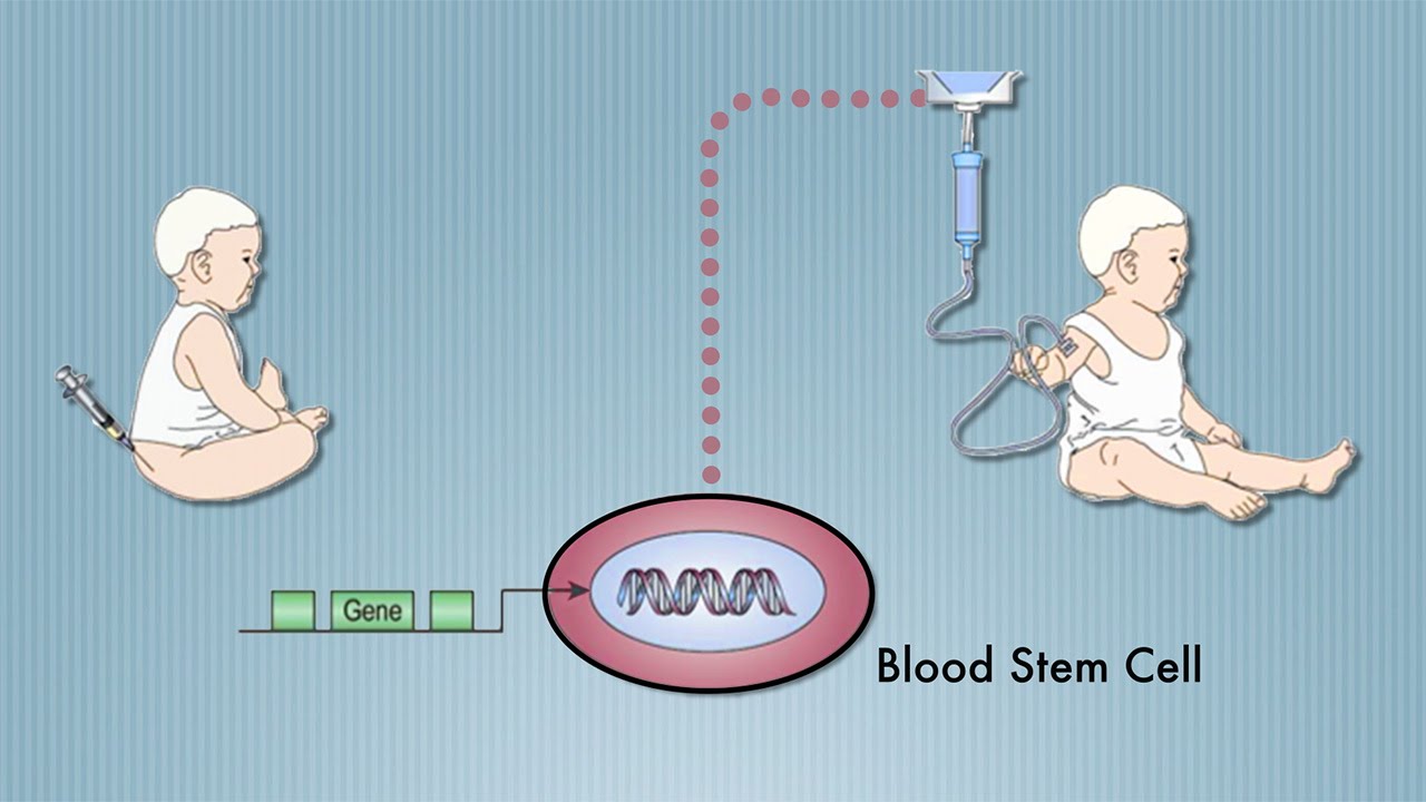 Stem Cell Cure for 