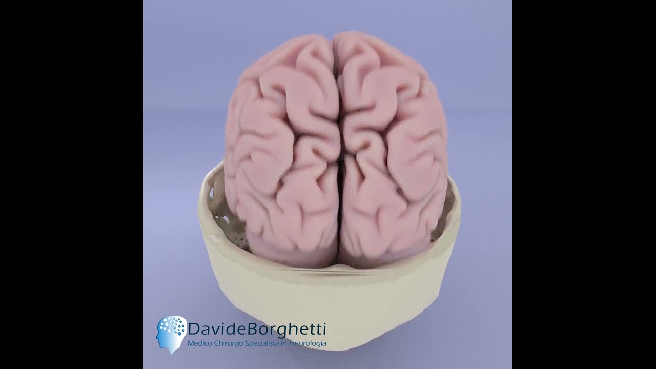 Che cosa succede durante un trauma cranico?