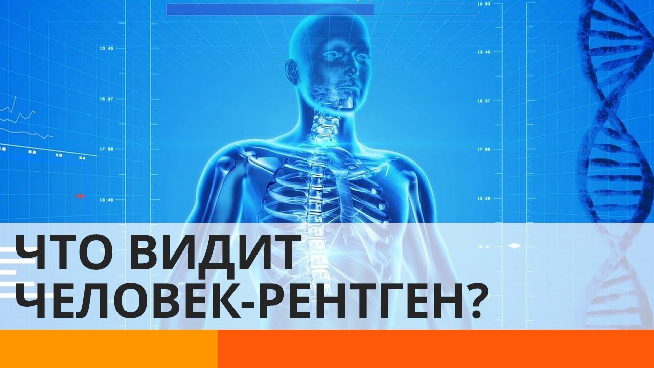 Человек-рентген: не мешают ли супер-способности в быту? — ICTV