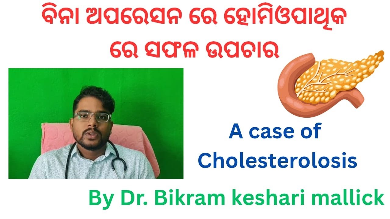 A case of cholesterolosis cured by homeopathic||cholesterol Homeopathic treatment||Dr Bikram 