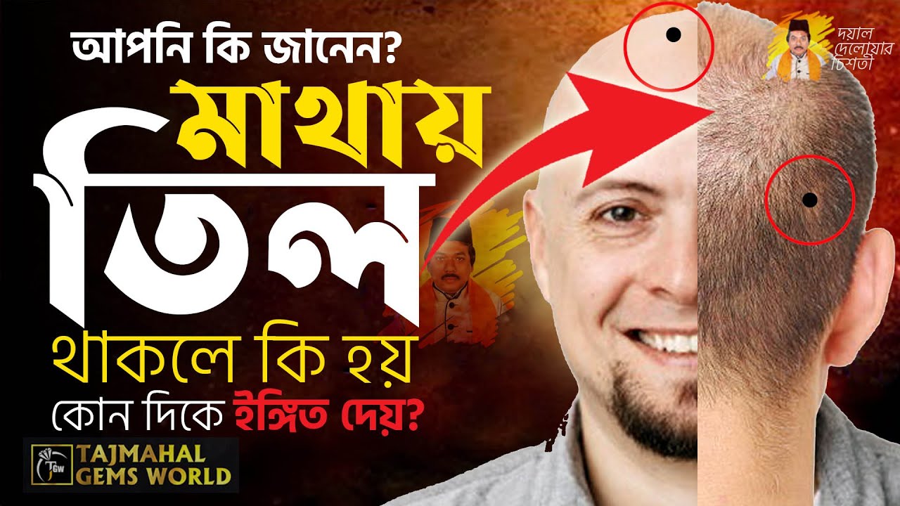 ভাগ্যবানদের মাথায় তিল থাকে, জেনে নিন কী বলছে শরীরের তিল থাকলে কি হয়!