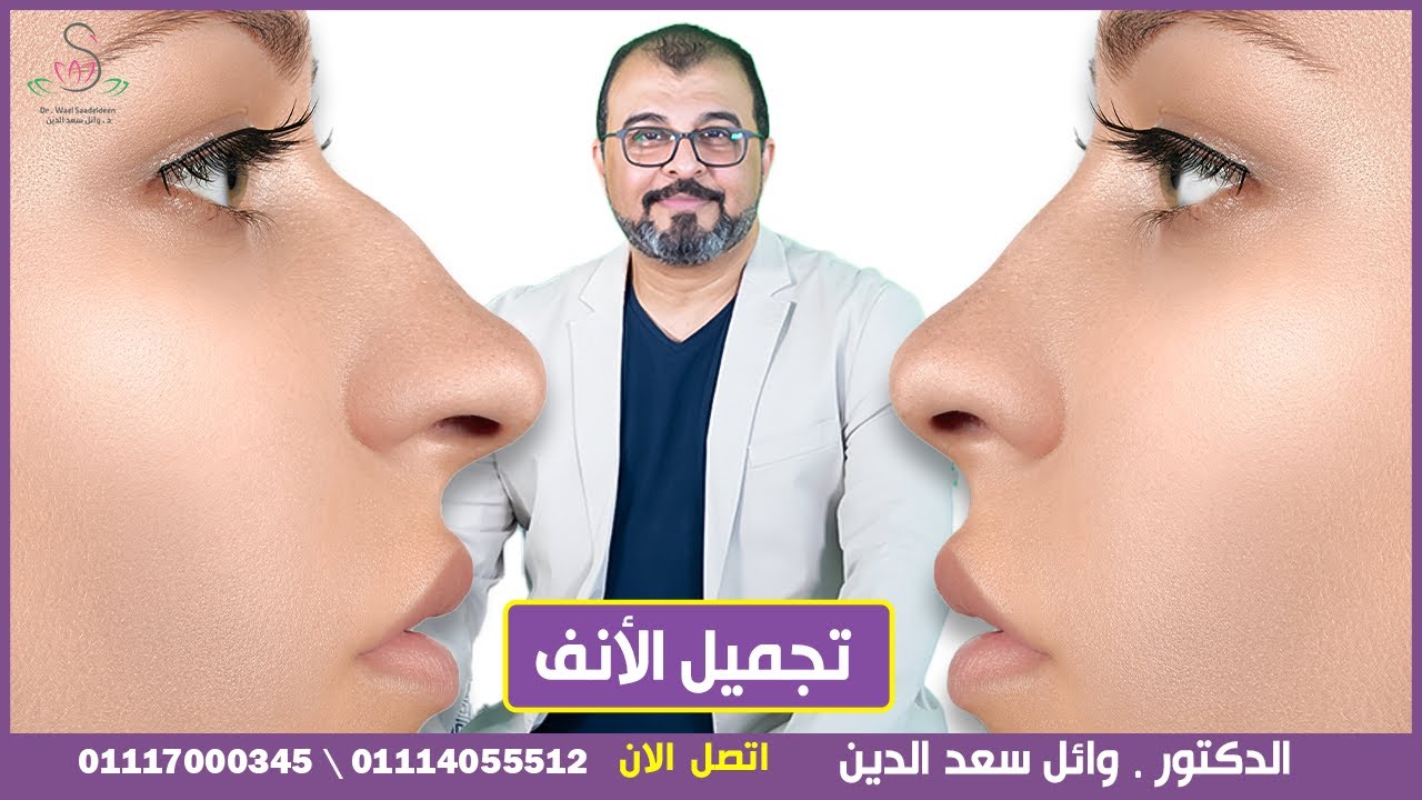 تجميل الانف بدون جراحة \ طرق حديثة تناسبك للإبراز جمالك بدون جراحة \ الدكتور وائل سعد الدين