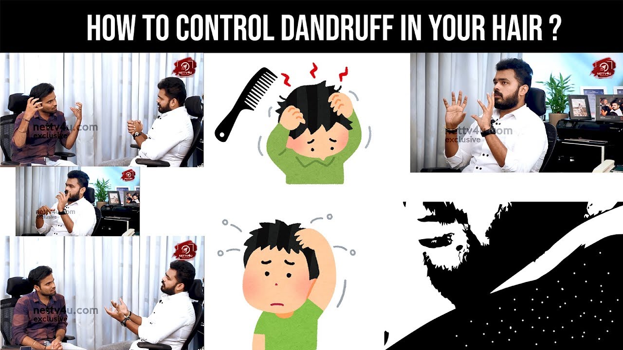 Want to control Dandruff ? How ? - Explains Vasanth Raj Guru of Hair & Beyond