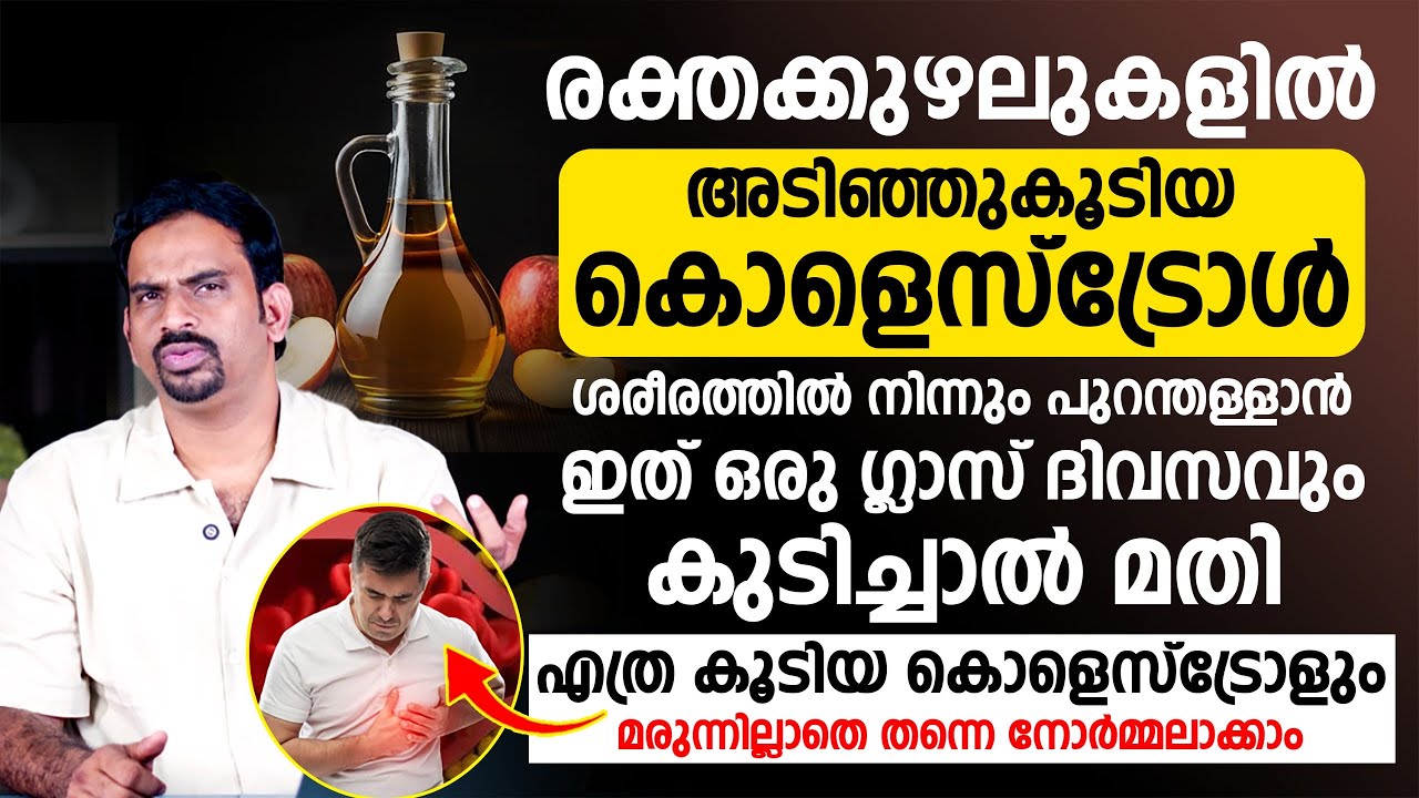 രക്തക്കുഴലിലെ കൊളസ്ട്രോൾ കുറയ്ക്കാൻ! | ഒരുഗ്ലാസ് വെള്ളം ദിവസവും മതി Dr Muhsin