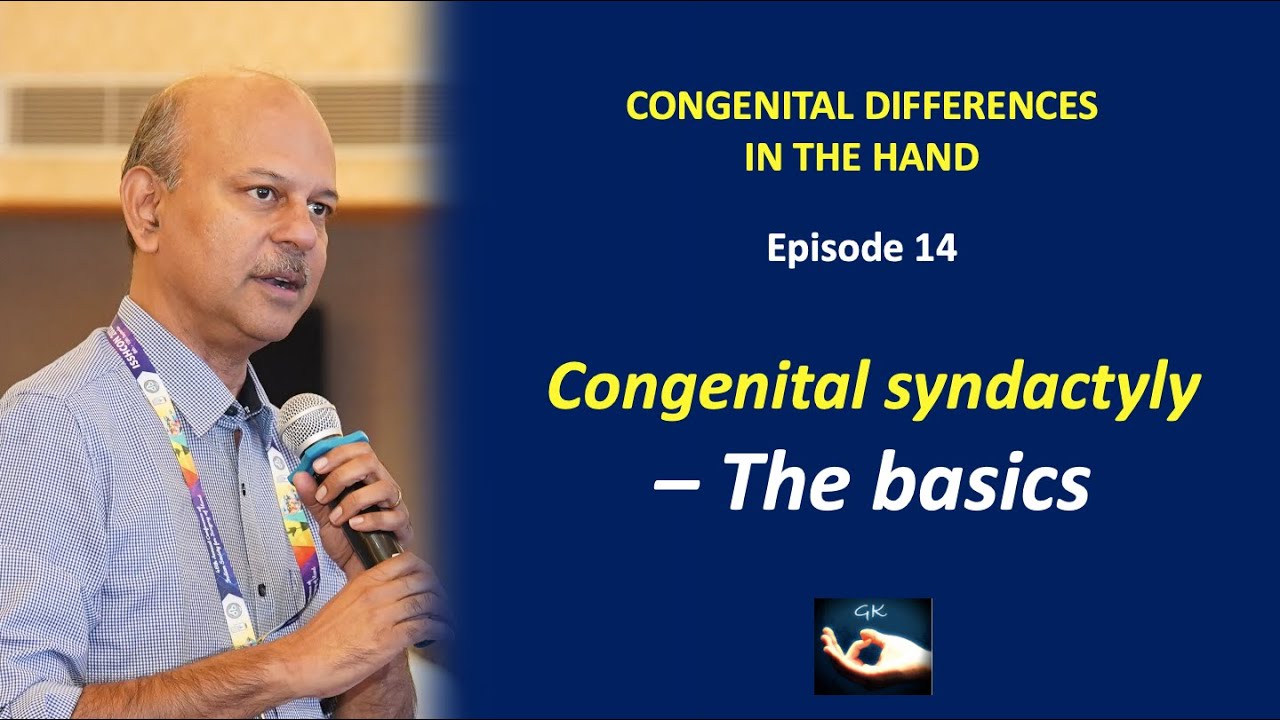 Congenital hand: Episode 14 - Congenital syndactyly - The basics - classification, and syndromes.