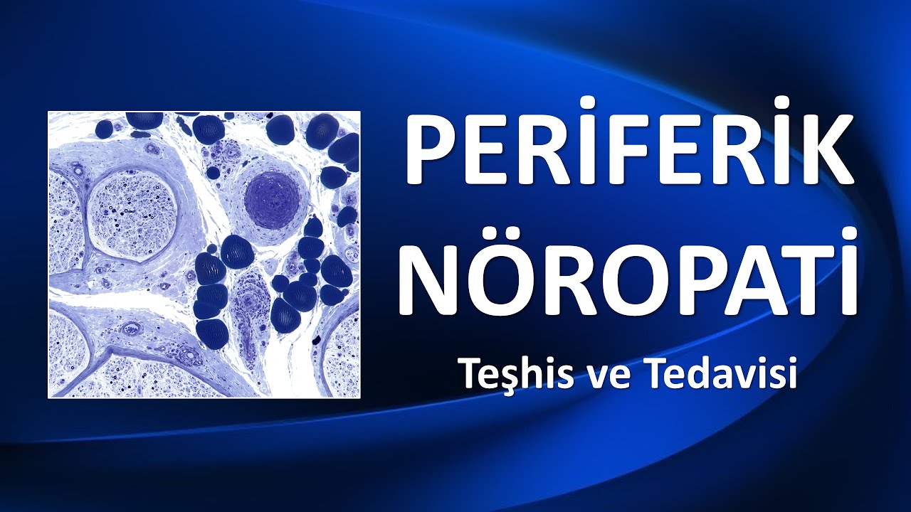 PERİFERİK NÖROPATİ Teşhis ve Tedavisi
