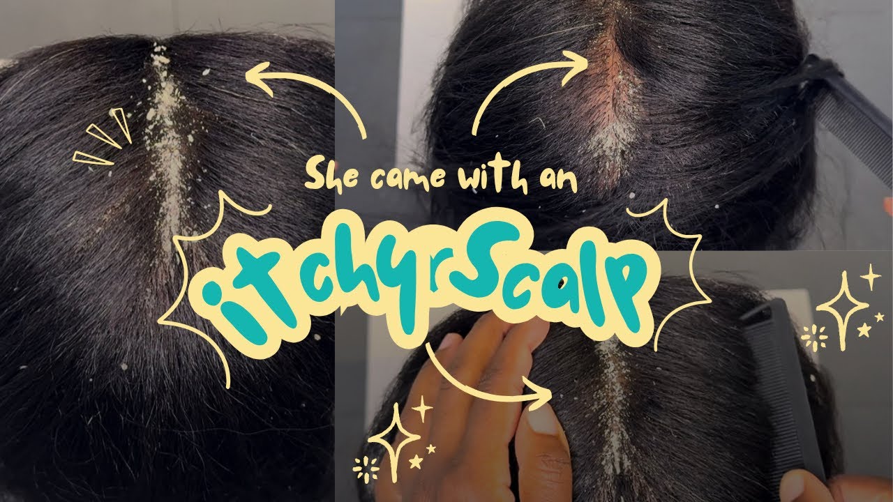 ASMR | Dandruff removal Hair scratching | Brushing | No talking | Oddly Satisfying