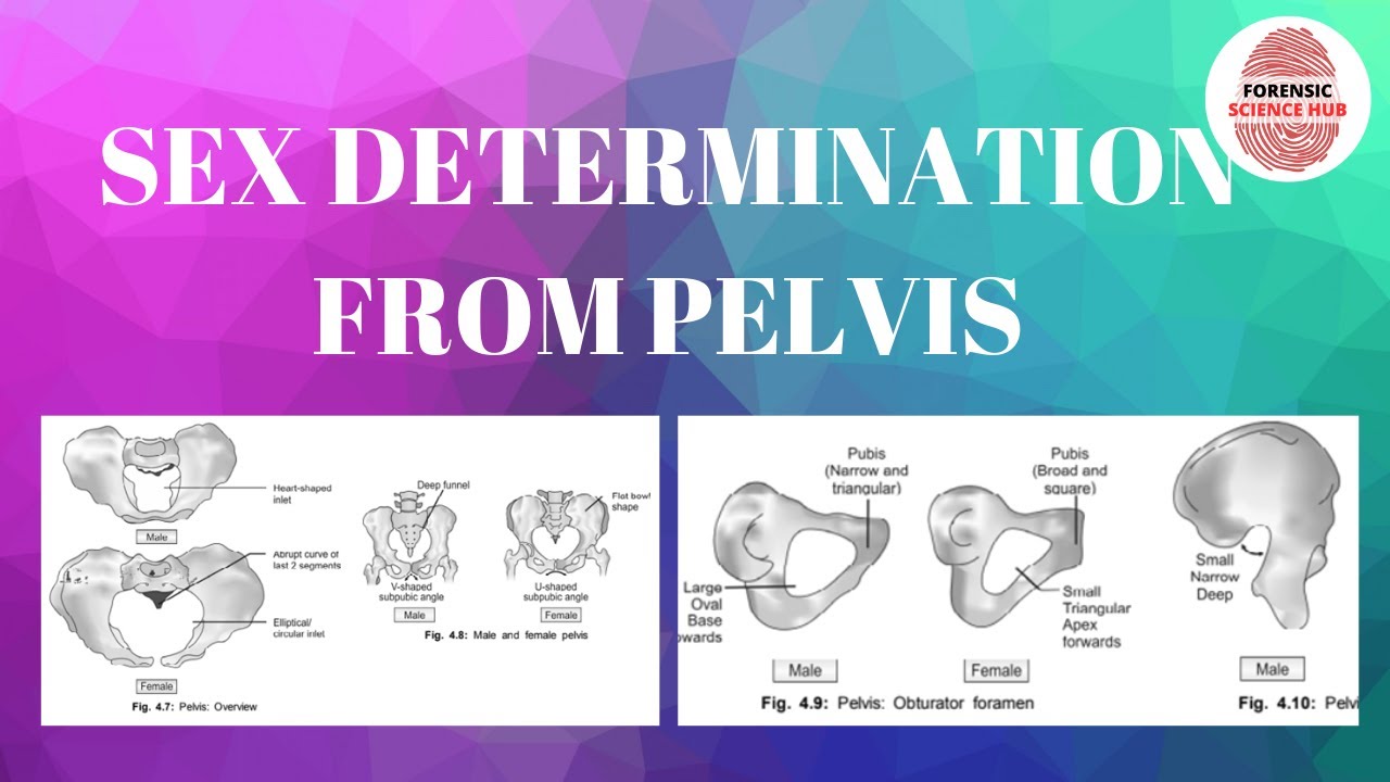 Sex determination through pelvis | Forensic medicine