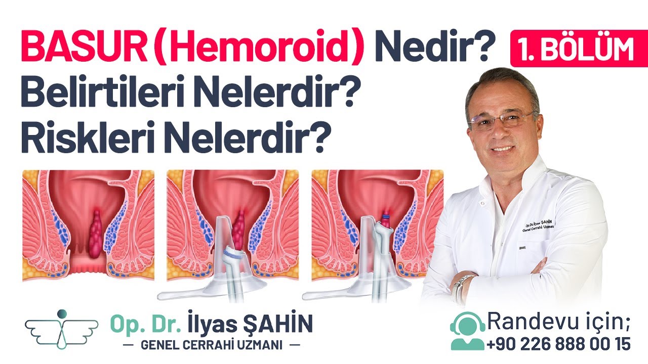 BASUR(HEMOROİD) NEDİR? BASUR (HEMOROİD) BELİRTİLERİ NELERDİR?