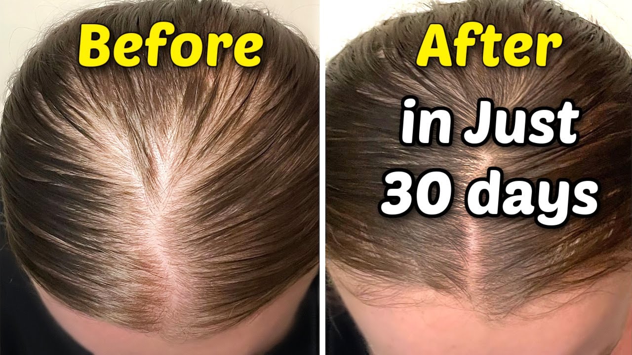 very thin hair to thick hair : Get Thicker Hair In 30 Day! how to get thicker hair naturally at home
