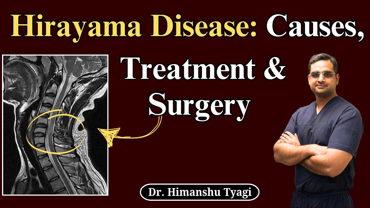 Hirayama Disease: Causes, Treatment & Surgery | Dr Himanshu Tyagi