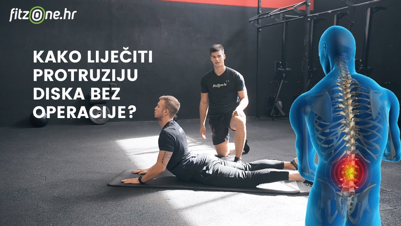 Riješite se tegoba koje donosi PROTRUZIJA DISKA uz ovih 6 vježbi! 🆘