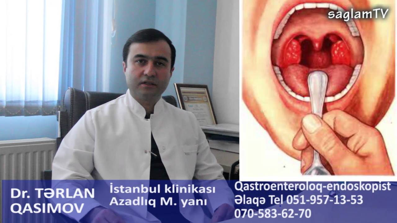 Ağızda pis qoxu varsa ? Dr. Terlan Qasımov. Qastroenteroloq-endoskopist.