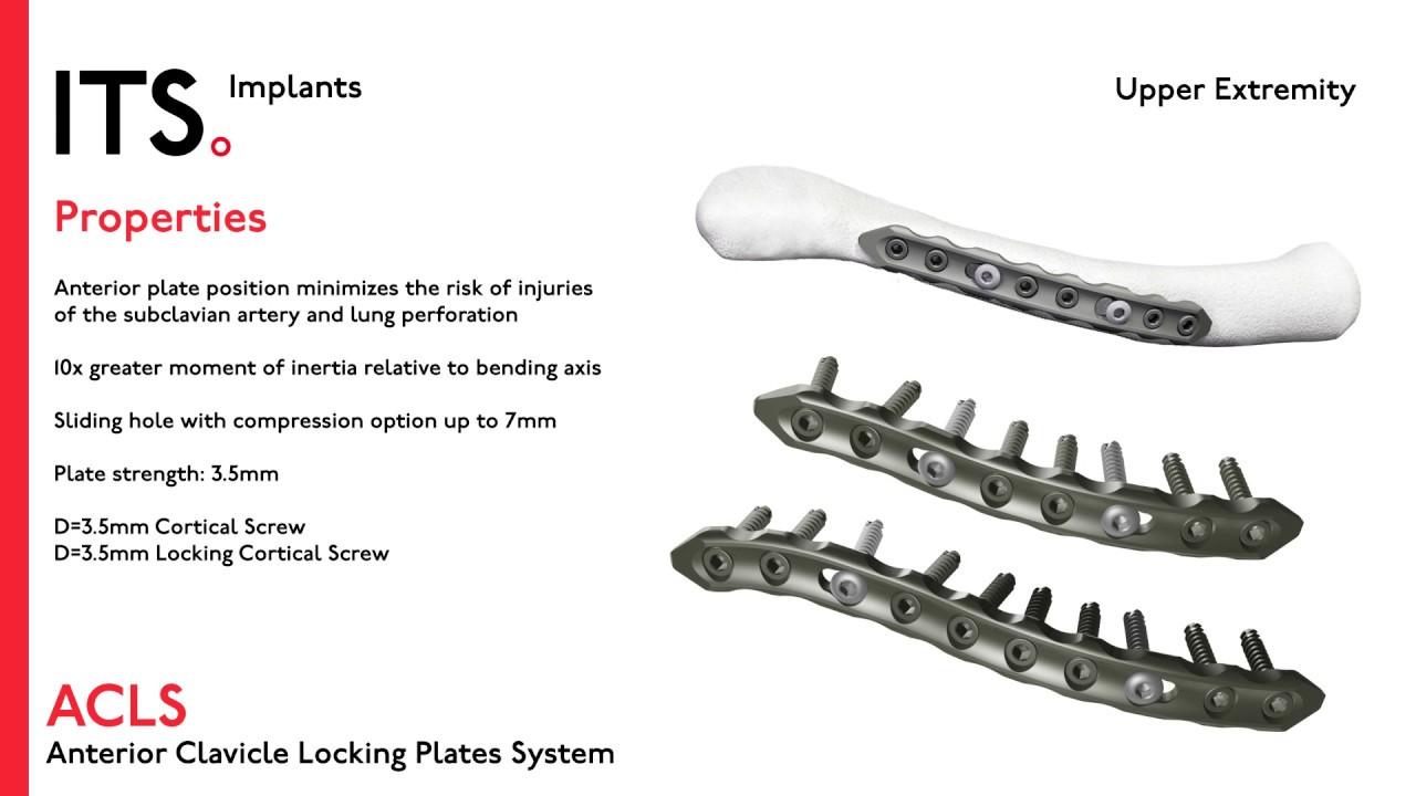 ITS. Orthopedic Implants for Trauma Surgery Overview