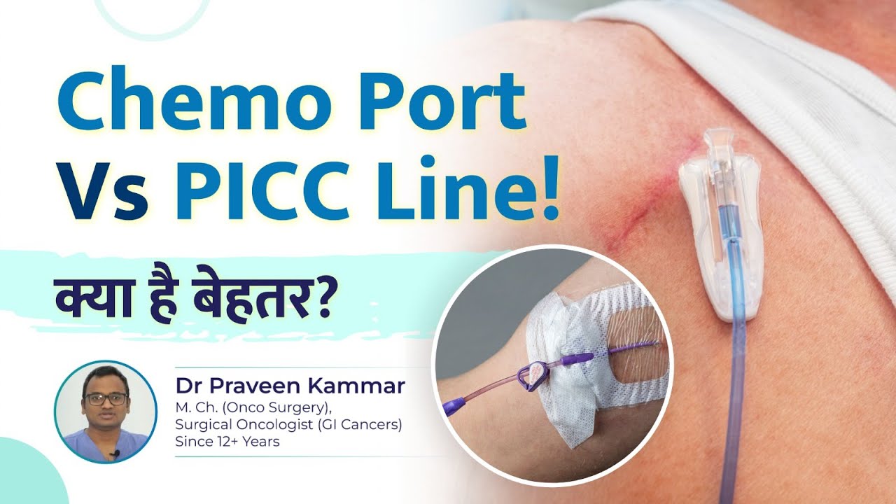 Chemo Port Vs PICC Line: क्या है बेहतर? | Which is Best for Chemotherapy? |Dr Praveen Kammar, Mumbai