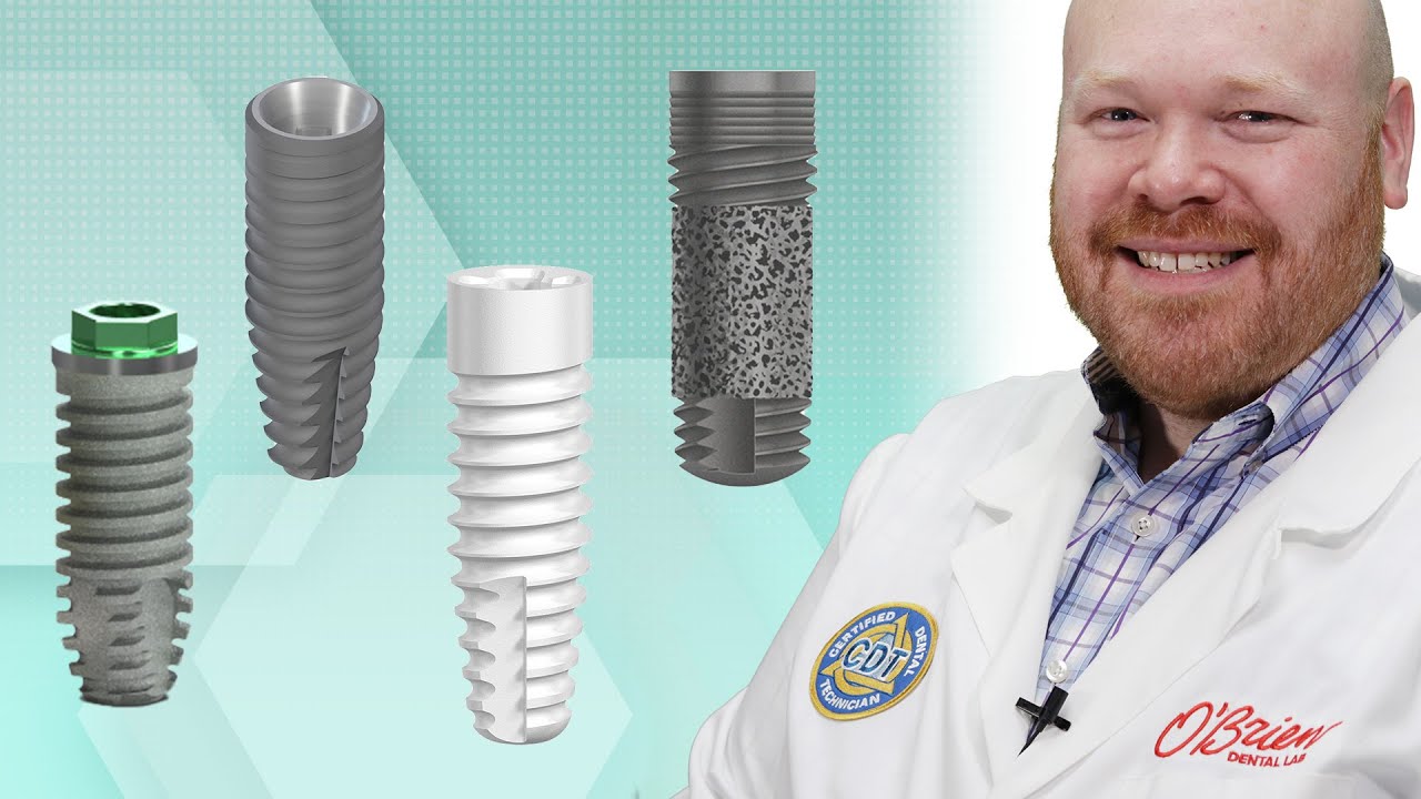 Which Implant System Should You Use?
