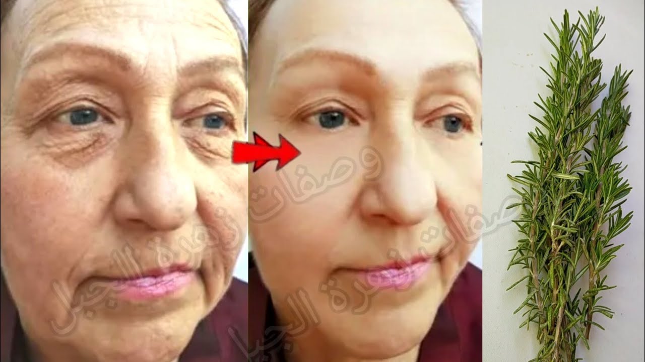 من اليوم متعاني من التجاعيد وصفة فعالة بالازير(اكليل الجبل)من التجربة الاولى غادي تصدمي فراسك
