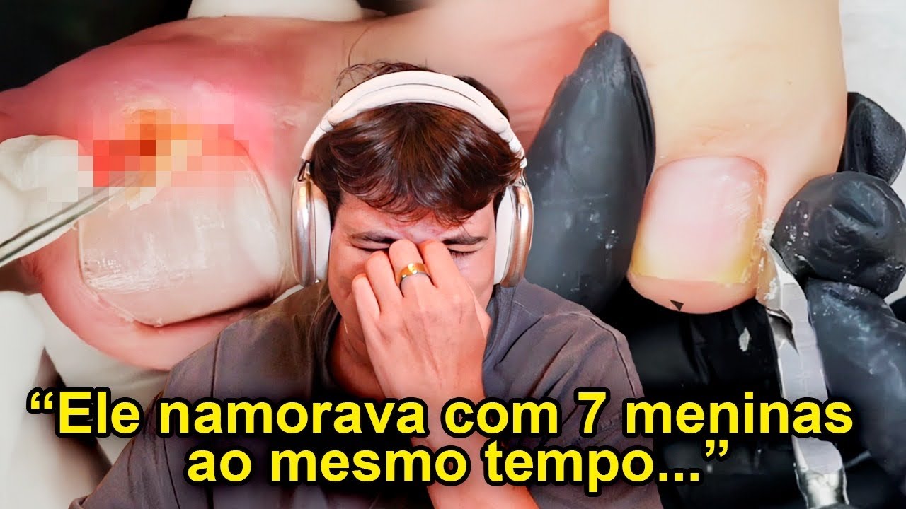 Hist&oacute;rias Absurdas do TikTok&hellip; e do nada uma unha encravada