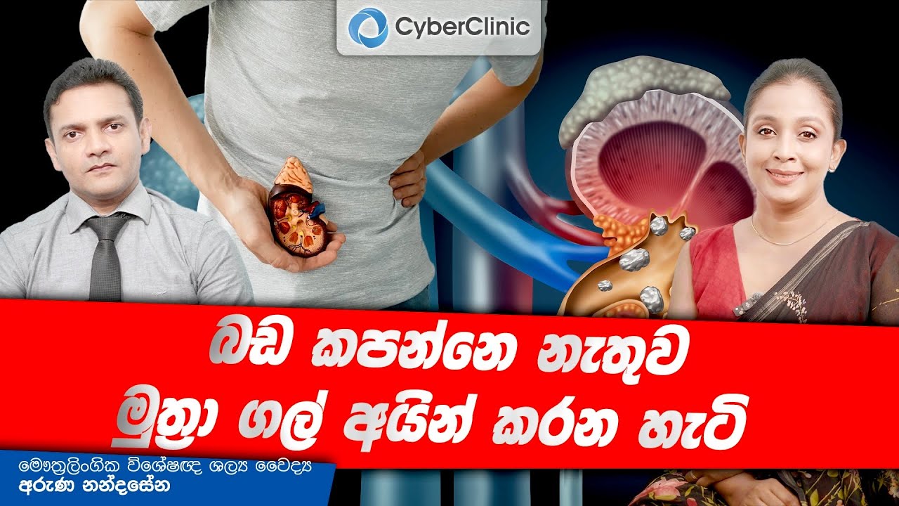 බඩ කපන්නෙ නැතුව මුත්‍රා ගල් අයින් කරන හැටි