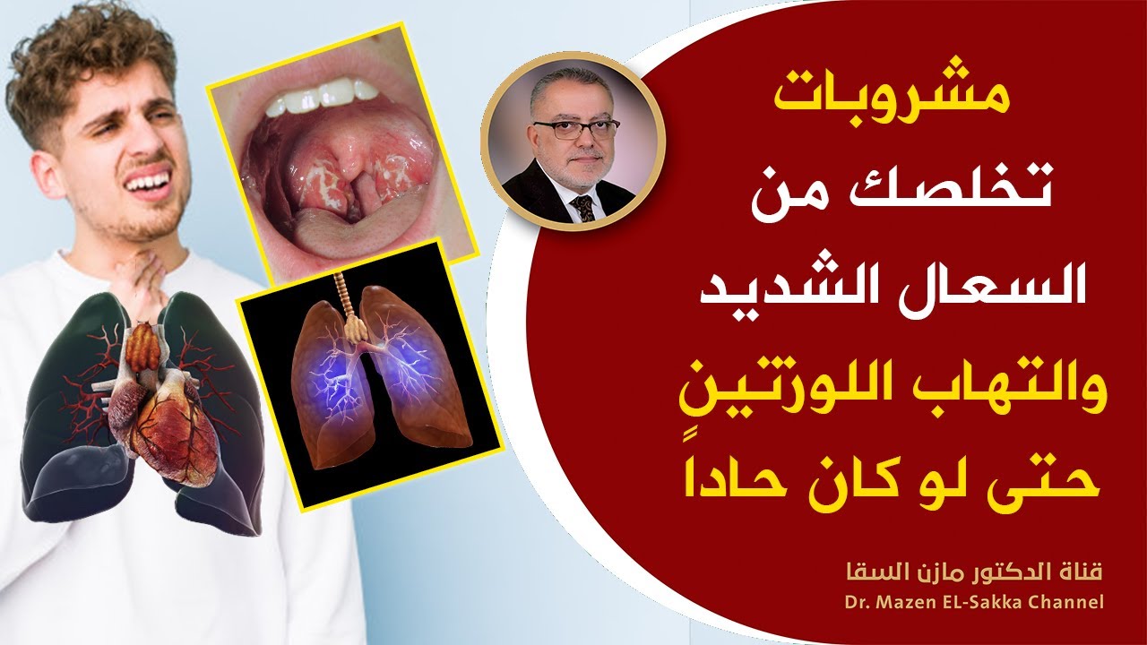 مشروبات تخلصك من السعال وتطهرالجيوب الأنفية واللوزتين وتنقي الصدر من البلغم مهما كان الإلتهاب حاداً