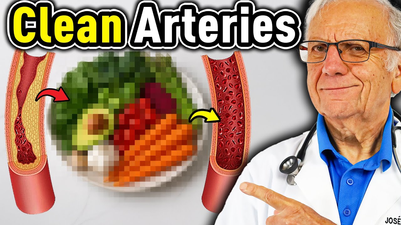 Top 10 Vegetables to Unclog Arteries & Prevent Heart Attacks.
