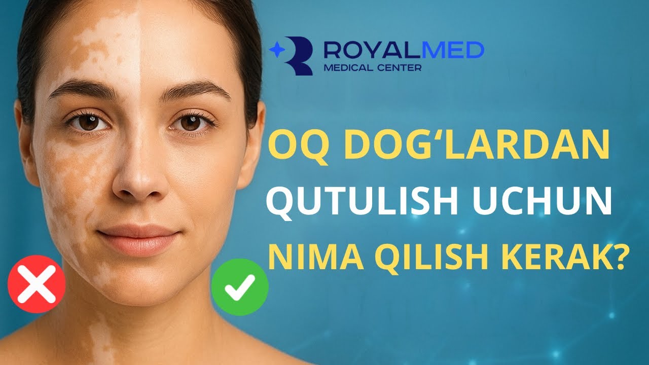 Oq dog' kasalligidan tuzalish uchun nima qilish kerak? | Ilyos Kamolov & Furqat Anziratov