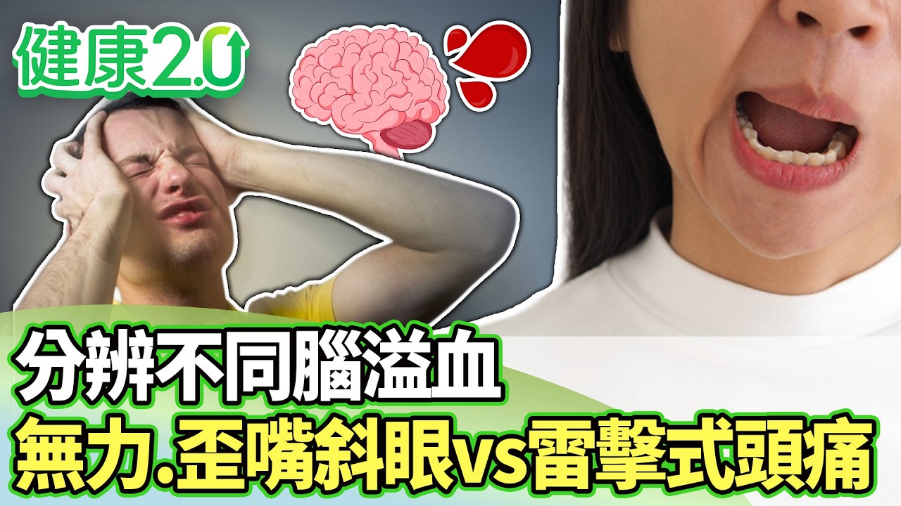 分辨不同腦溢血 無力、歪嘴斜眼vs.雷擊式頭痛【健康2.0分段】@tvbshealth20  EP3179-1 20260315 #陳欣湄#韋汝#劉恆維#林謂文#沈瑞斌#葉懿昕