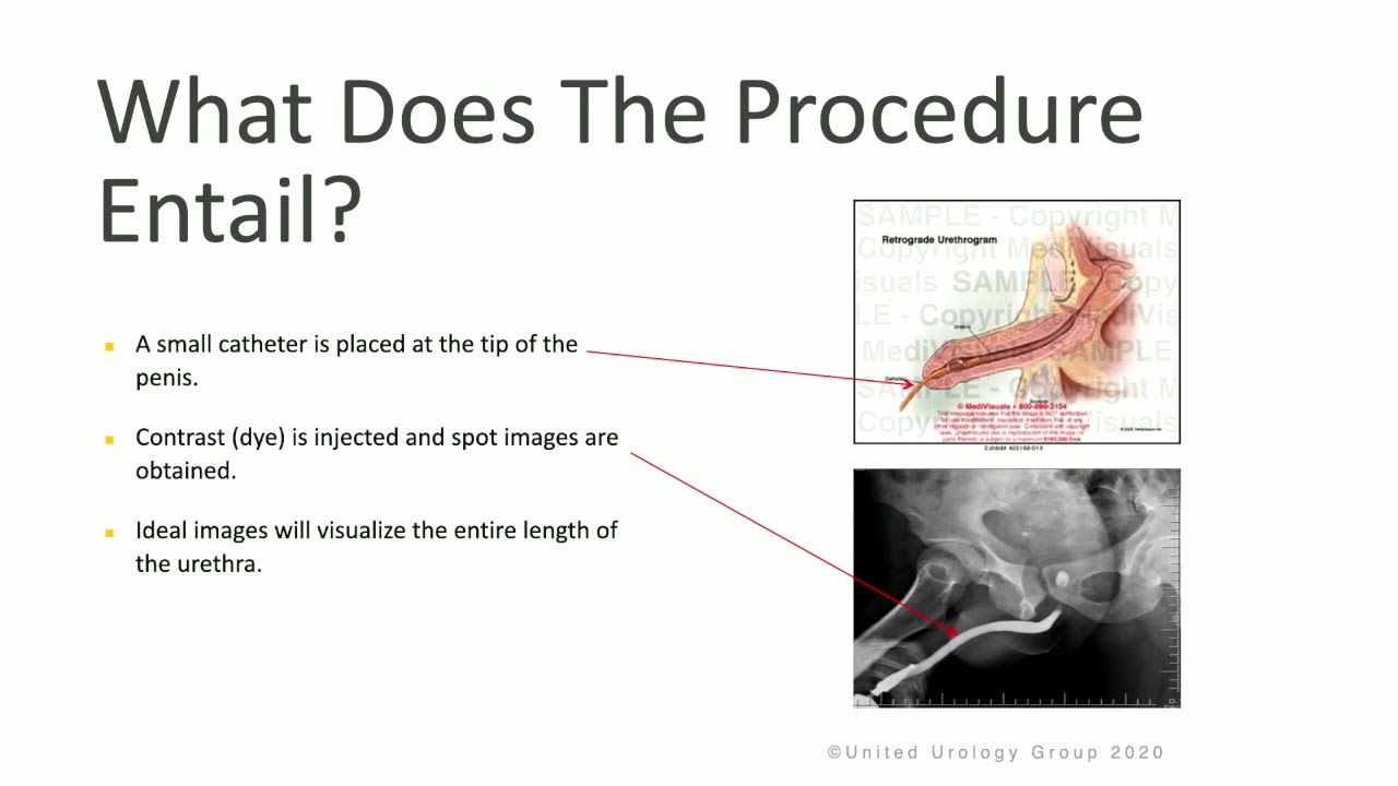 Retrograde Urethrogram & voiding Cystourethrogram