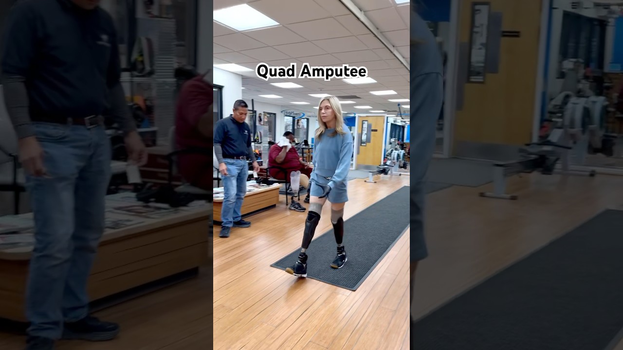 Ilysa, Quad Amputee, Navigates Life with Her Prosthetics!