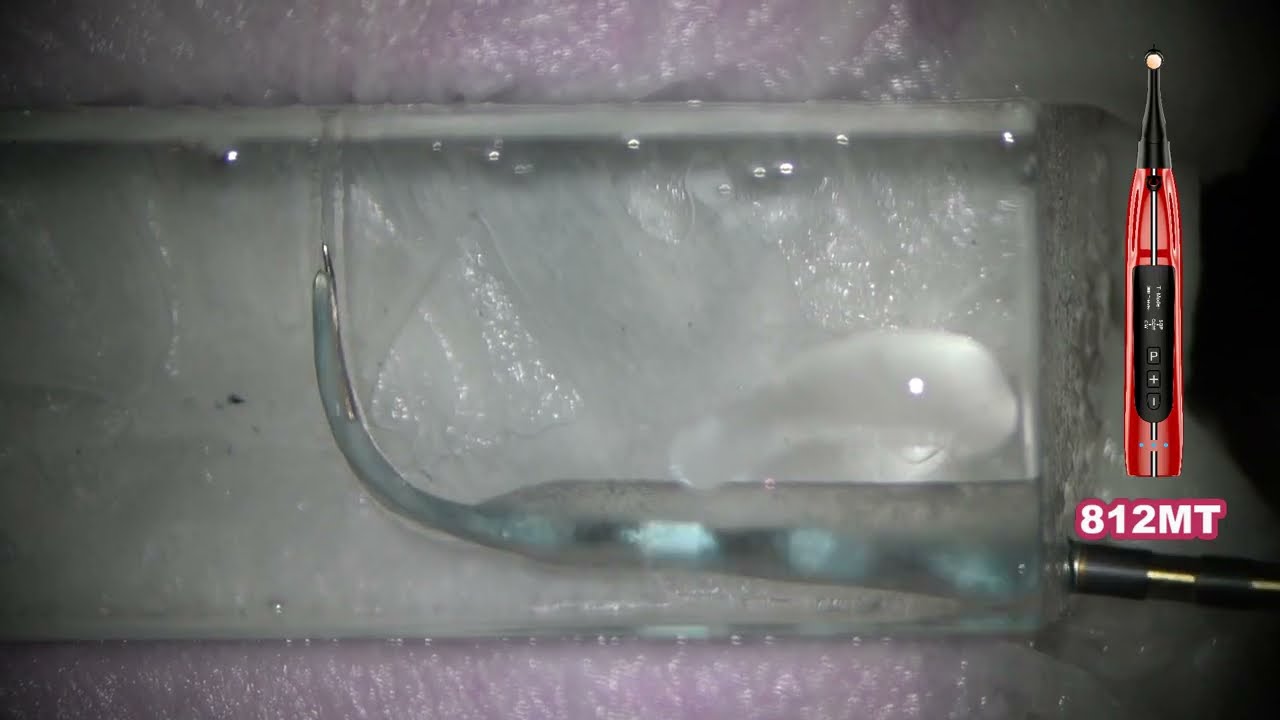 Broken file removal far beyond the curve using Race Evo files in T mode of Ai motor/Race Evoの破折器具除去