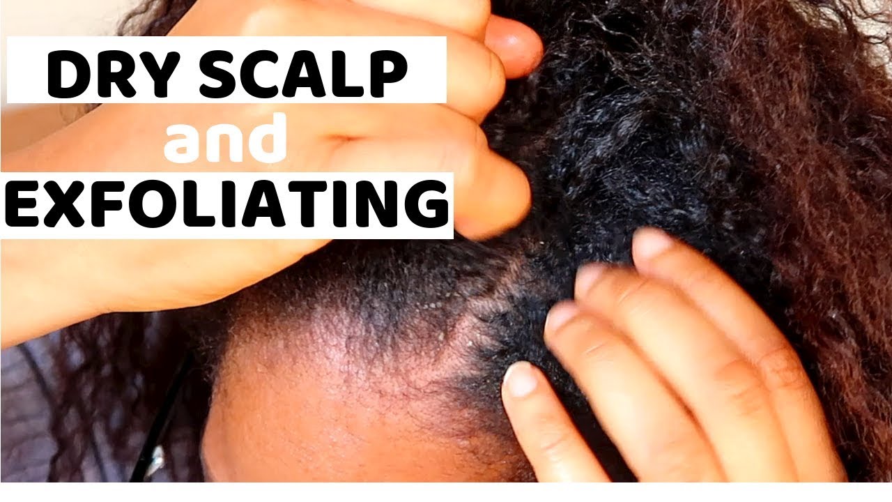 DRY SCALP TREATMENT during WINTER ❄️⛄️ and EXFOLIATING SCALP | Natural Hair