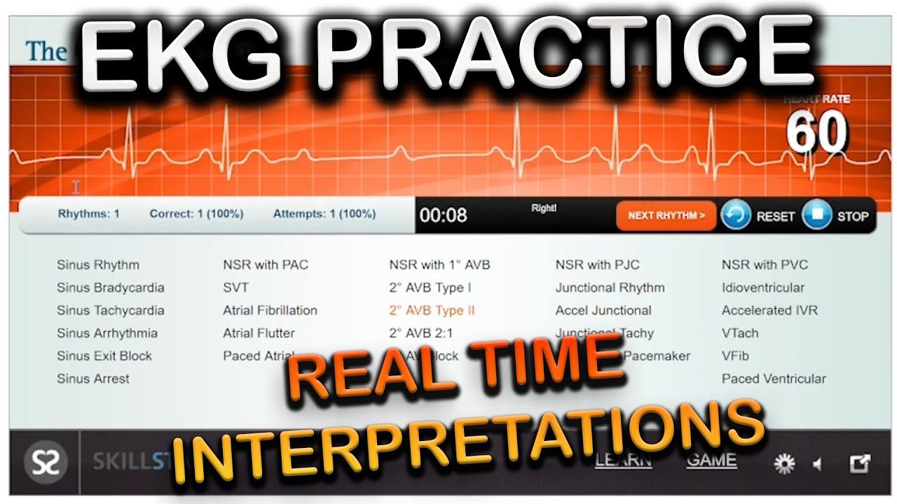 EKG Real Time Practice Interpretations!  (EMS)