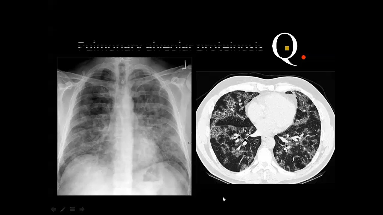 Chest imaging Quiz Cases   Prof  Dr  Mamdouh Mahfouz