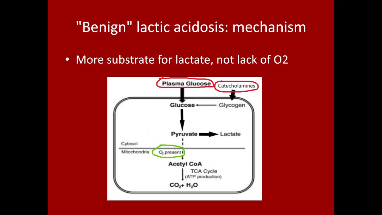 Low Cardiac Output Syndrome