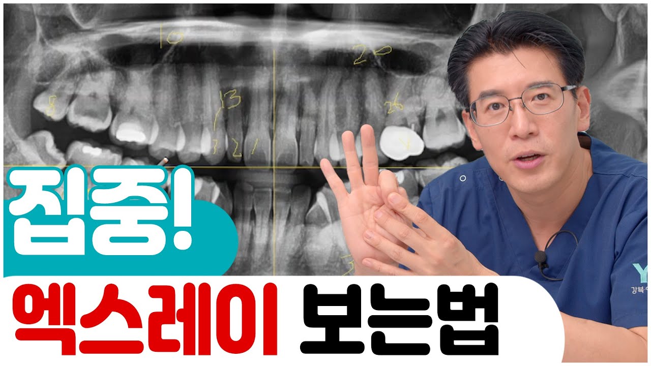치과의사처럼 엑스레이 보는 방법을 공개하겠습니다!!