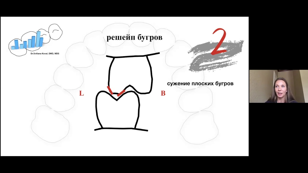 Webinar 2: Окклюзионная эквилибрация и Пришлифовывание контактов по данным Т-скан. Высота прикуса.
