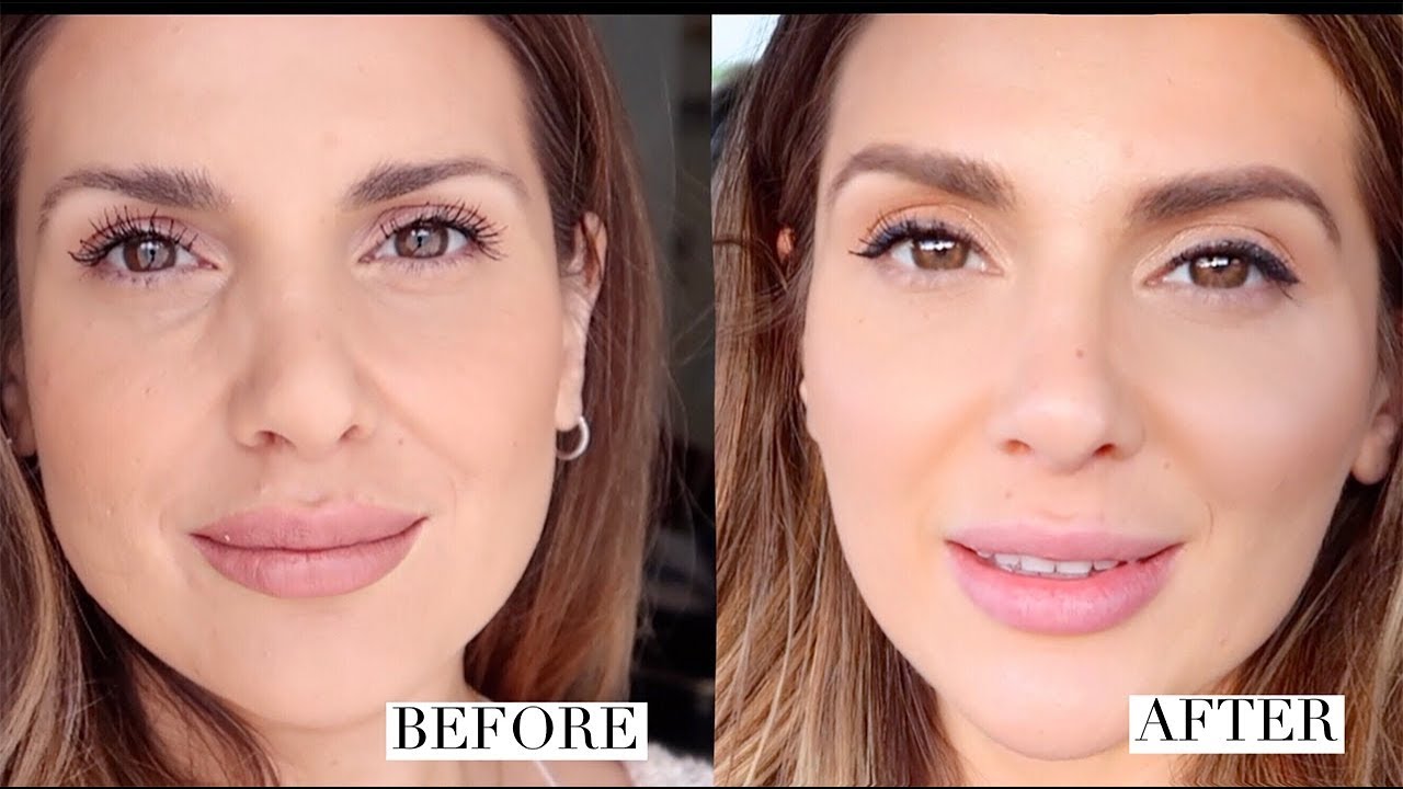 HOW I GOT RID OF UNDER EYE HOLLOWS AND IMPROVED MY OVERALL LOOK |  ALI ANDREEA