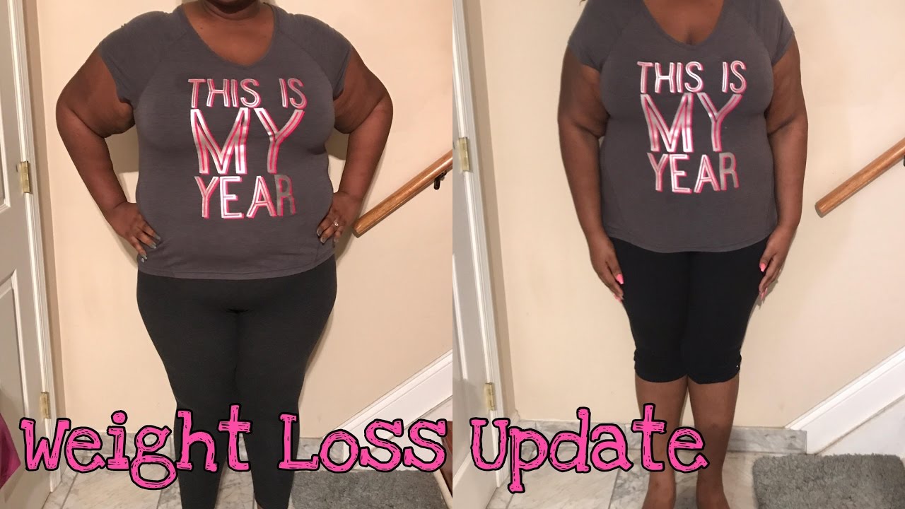 6 week post Gastric Bypass!  Weight loss? Dumping? FAQ'S