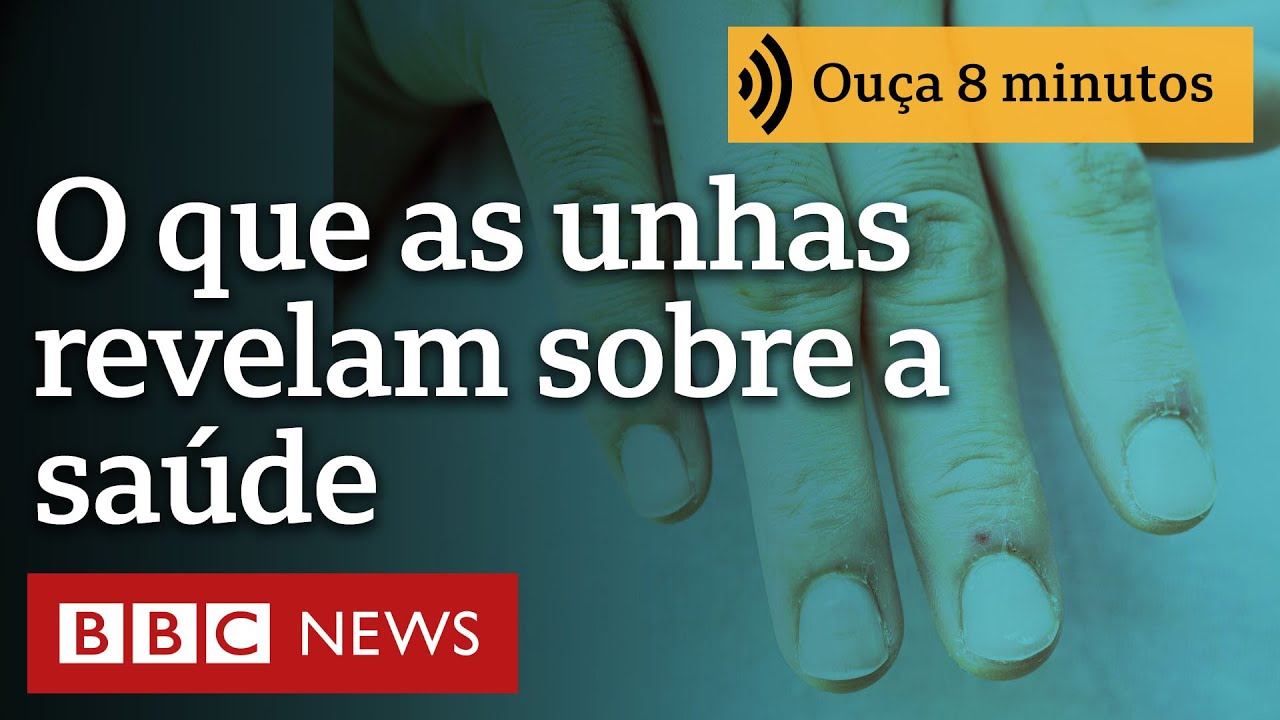 O que as unhas revelam sobre a sua saúde