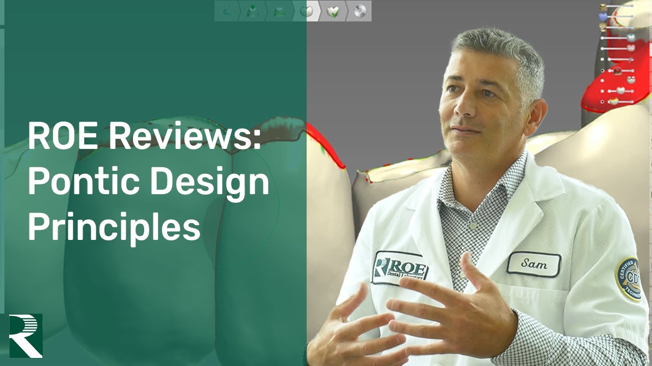ROE Reviews: Pontic Design Principals