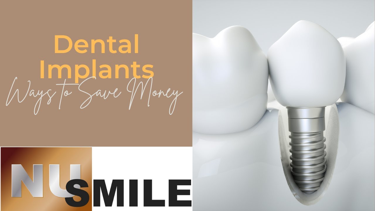 How You Can Save Money on Dental Implants