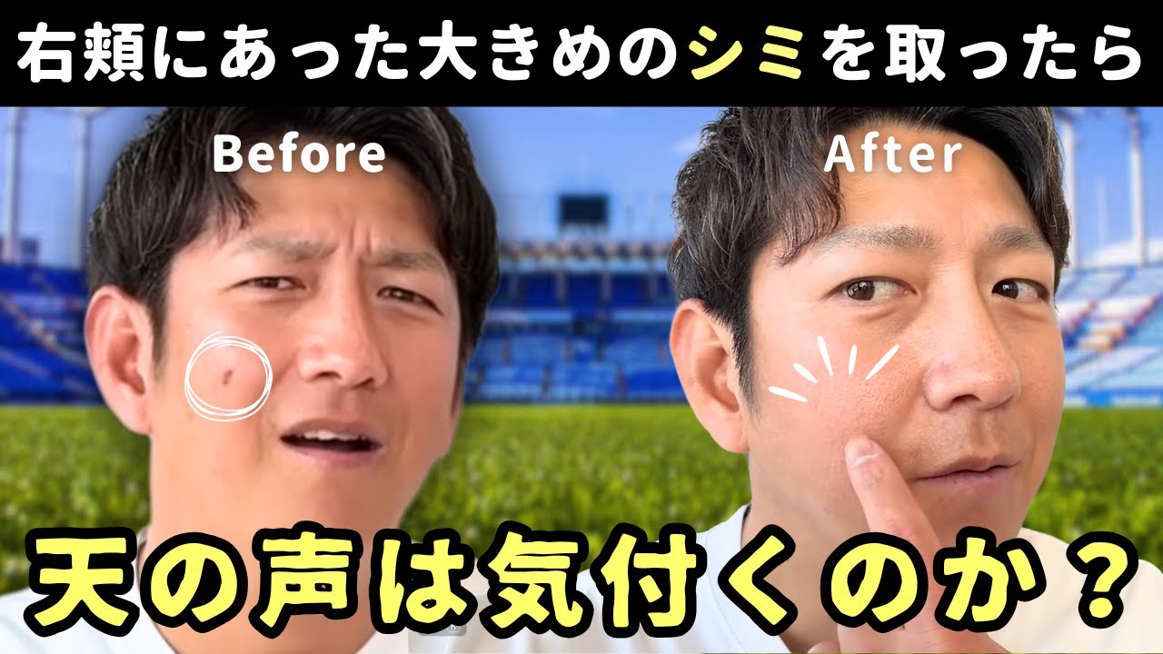 右頬にあった大きめのシミを取ったら、天の声は気付くのか？