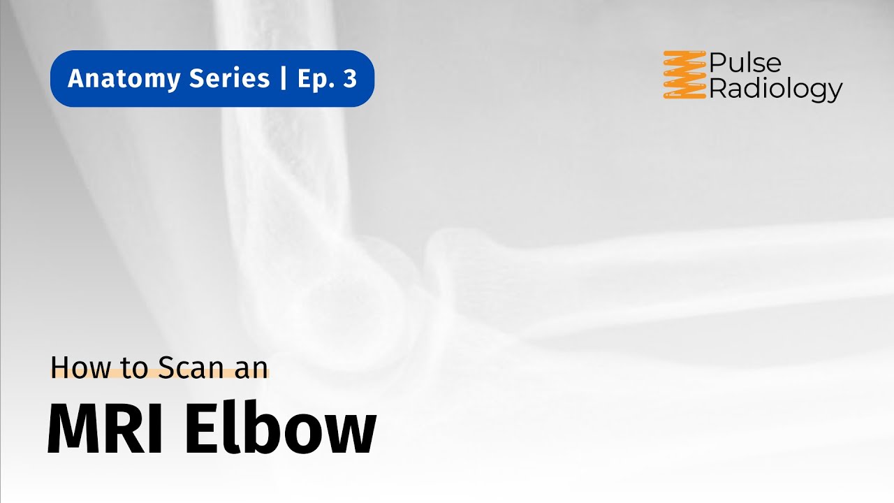 How to Scan an MRI Elbow