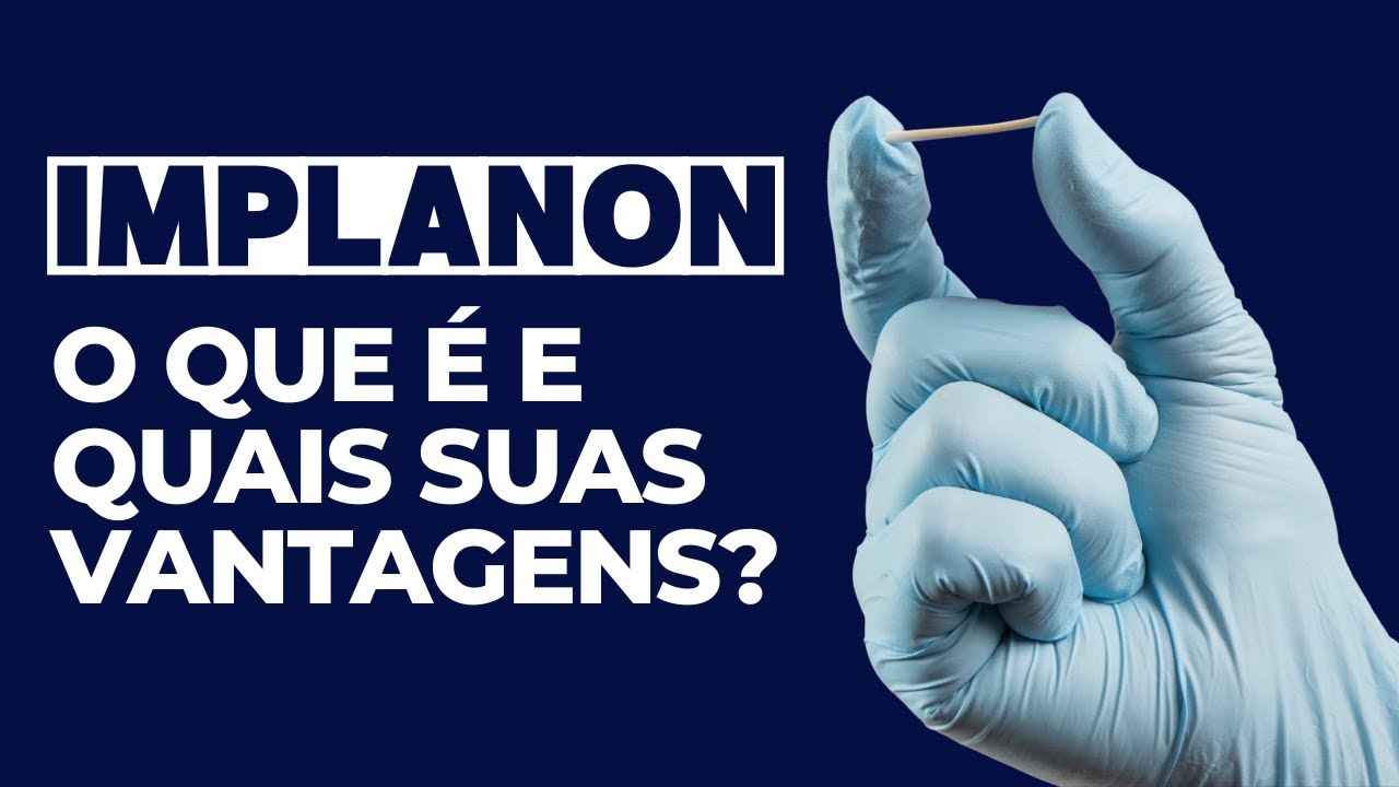 O que é IMPLANON e quais suas vantagens?